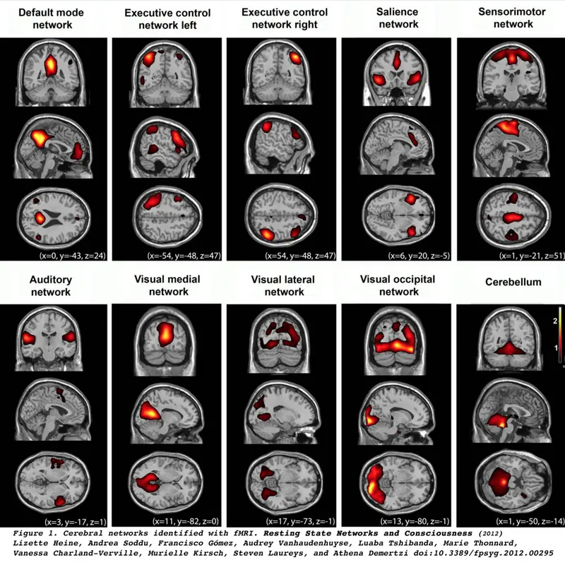 fMRI scan showing the large-scale networks of a living human brain